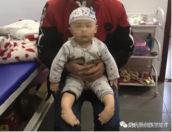 孩子足内翻跟腱术后怎样恢复,马蹄内翻足手术是切断跟腱嘛