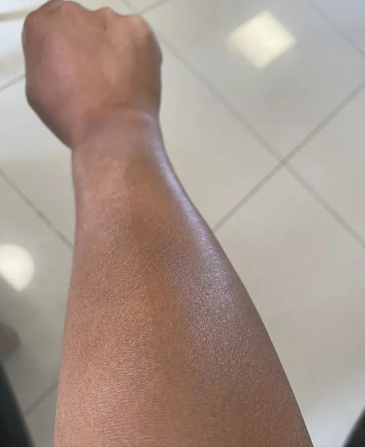 空调房待久了干燥,空调房呆久了皮肤干燥怎么办