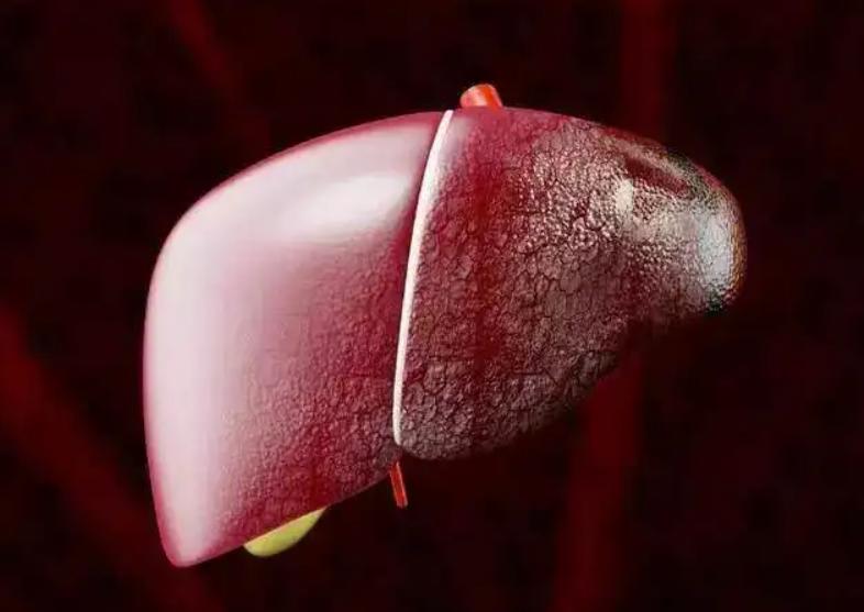 肝纤维四项正常b超提示回声增粗,肝纤维四项和肝弹性检测哪个准确