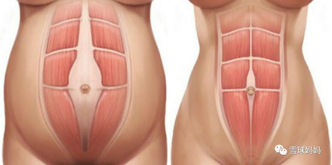 雷佳音曝汤唯尿频被指情商低,汤唯产后尿频