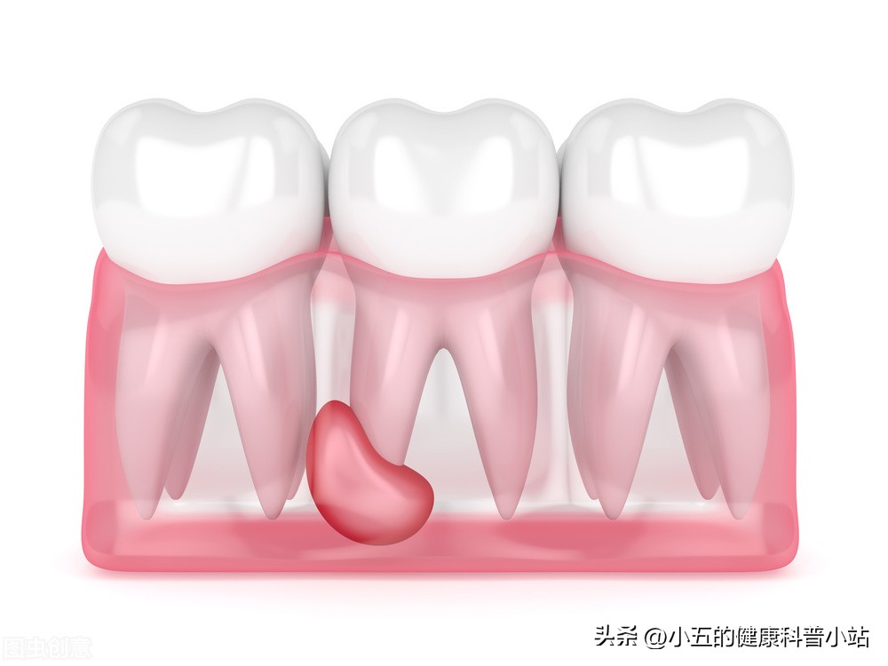 老年人牙齿敏感怎么治疗,老人牙敏感怎么办最快最有效