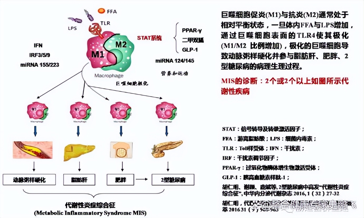 改善动脉粥样硬化的中药,如何通过食疗调理动脉粥样硬化