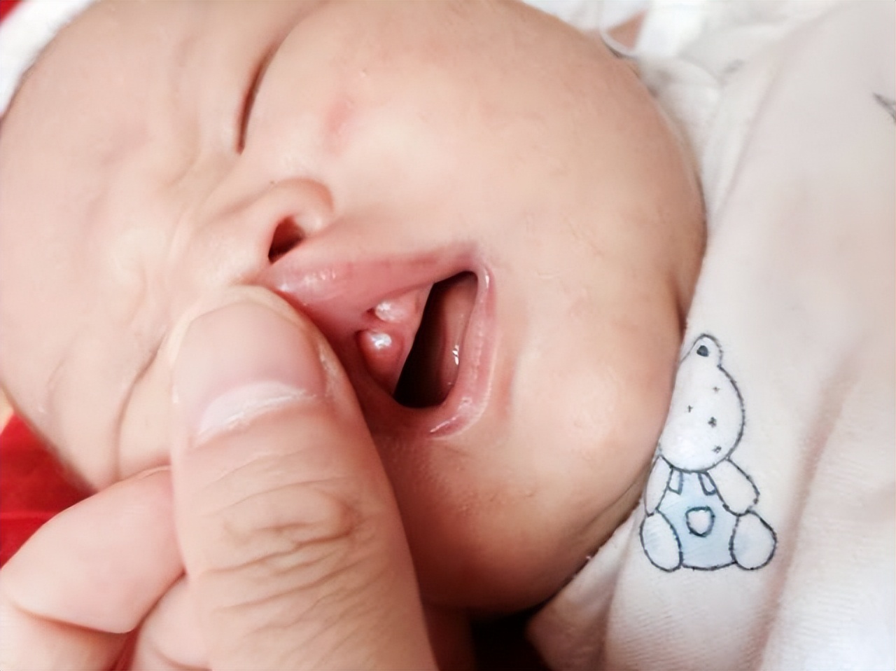 注意这6个口腔健康误区,儿童口腔护理误区