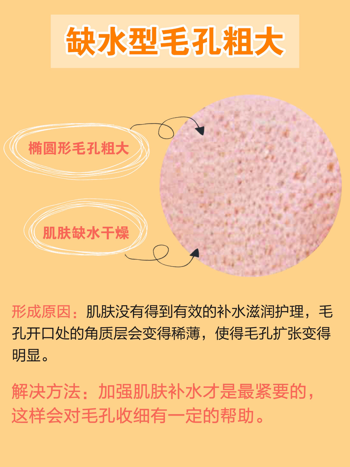 毛孔粗大也有办法改善皮肤科普,毛孔粗大最全攻略解决办法