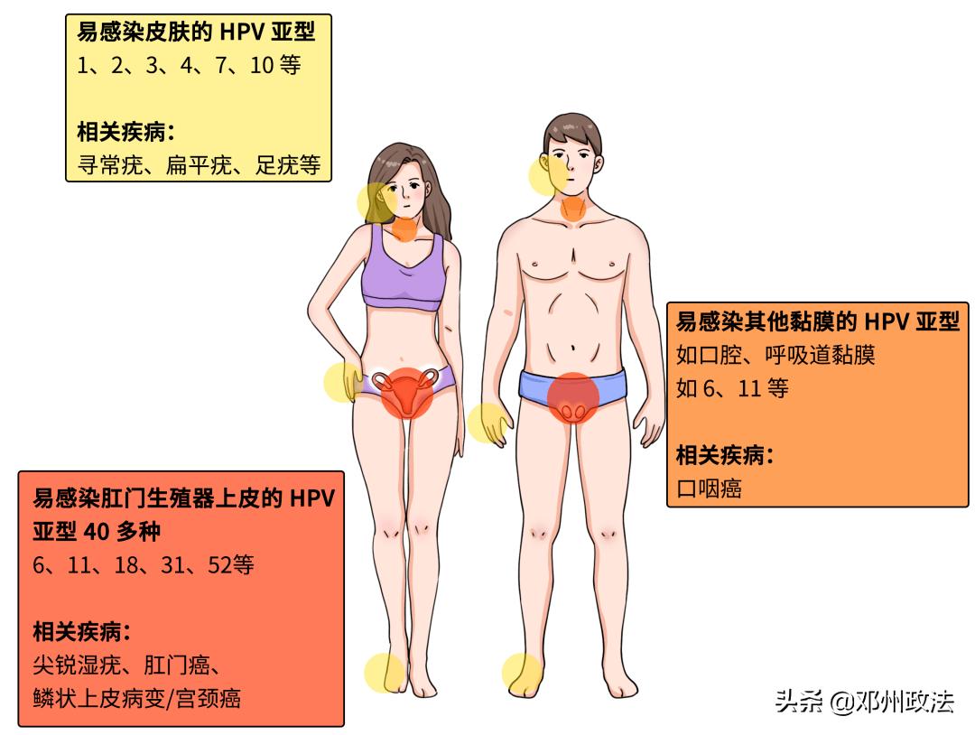 皮肤上hpv小肉粒,皮肤上的赘肉是hpv吗