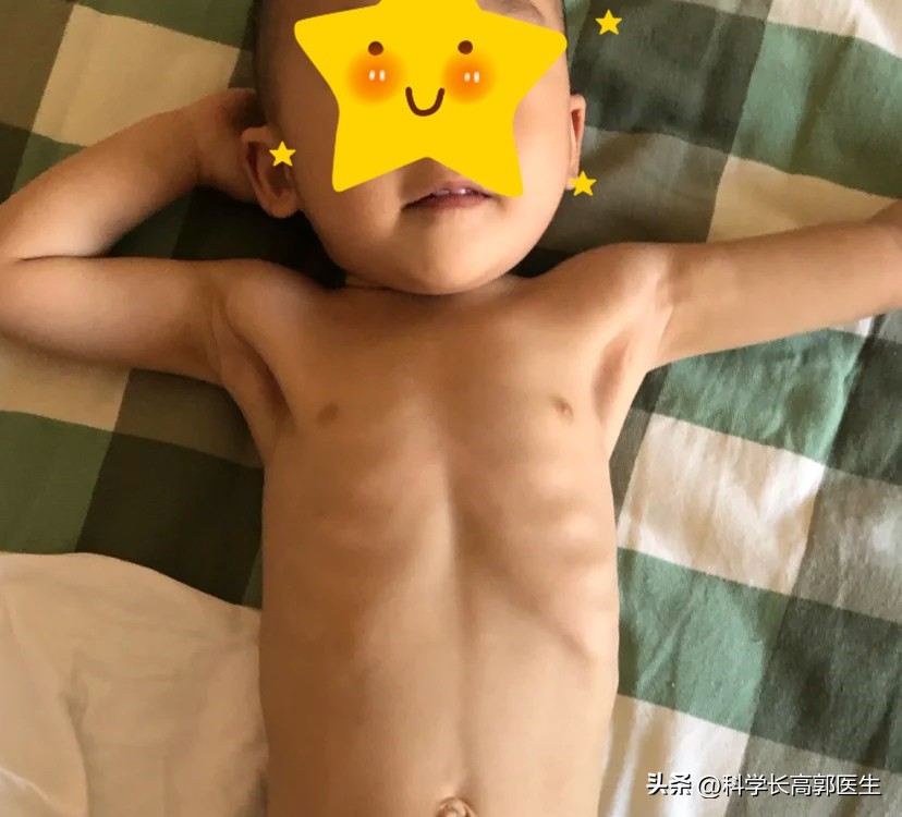 孩子瘦吃饭也不长怎么办,儿童体质弱不长肉怎么办