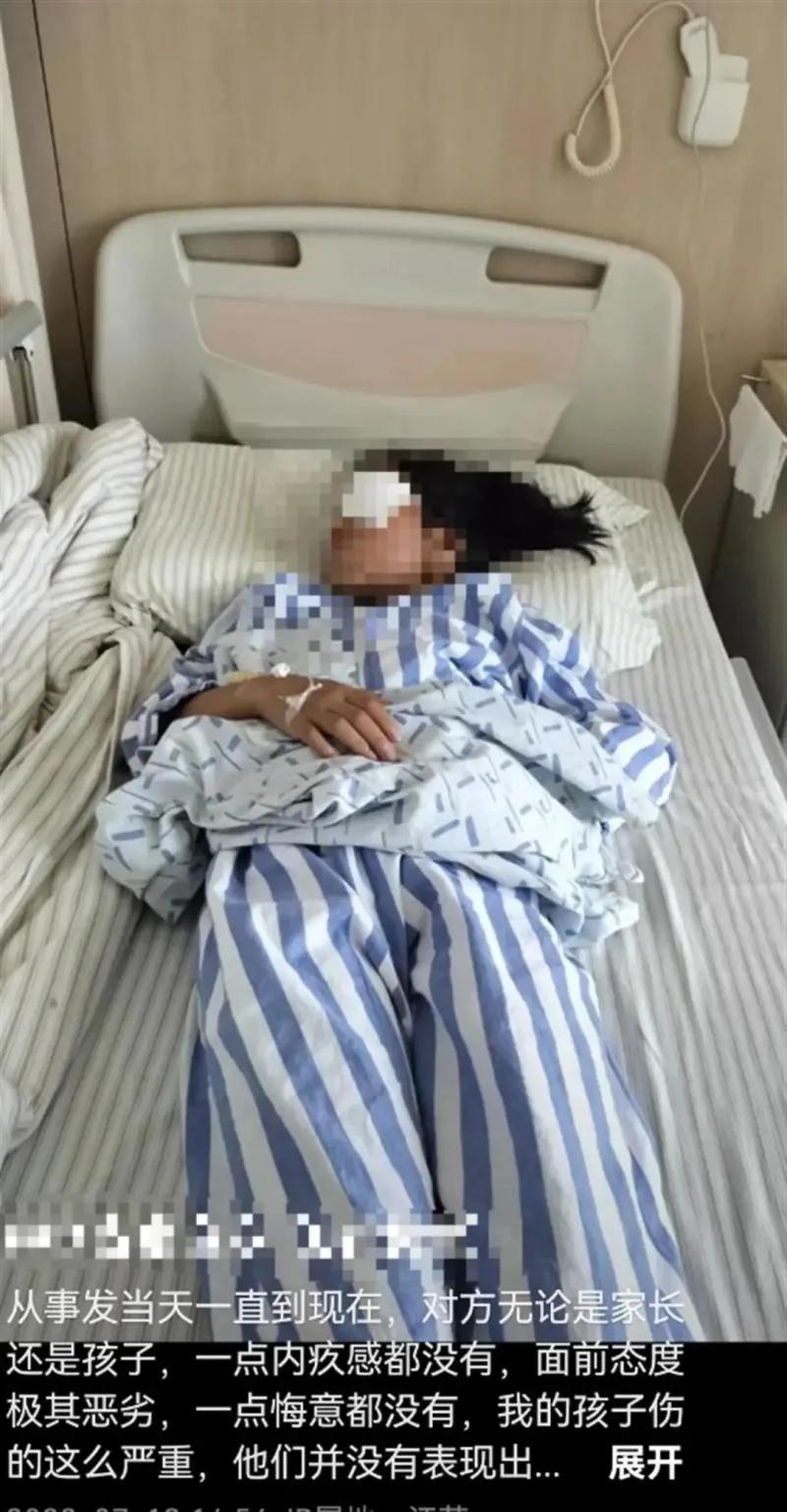 女童被射瞎,被射伤眼球女孩后续