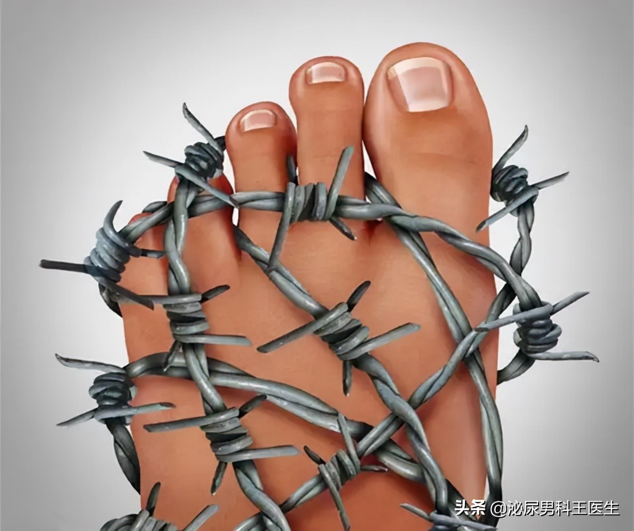 尿酸过高怎么能快速排出尿酸,尿酸高如何排出