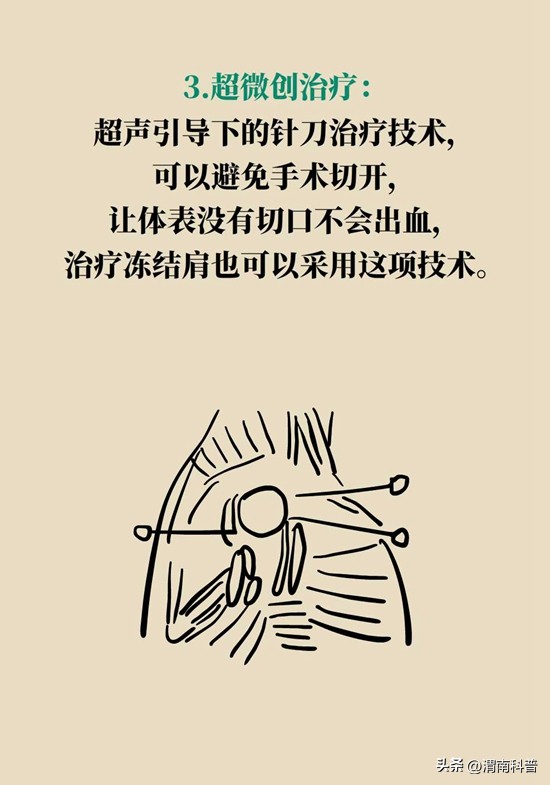 肩膀不抻不疼一抻就疼,肩膀往后伸疼