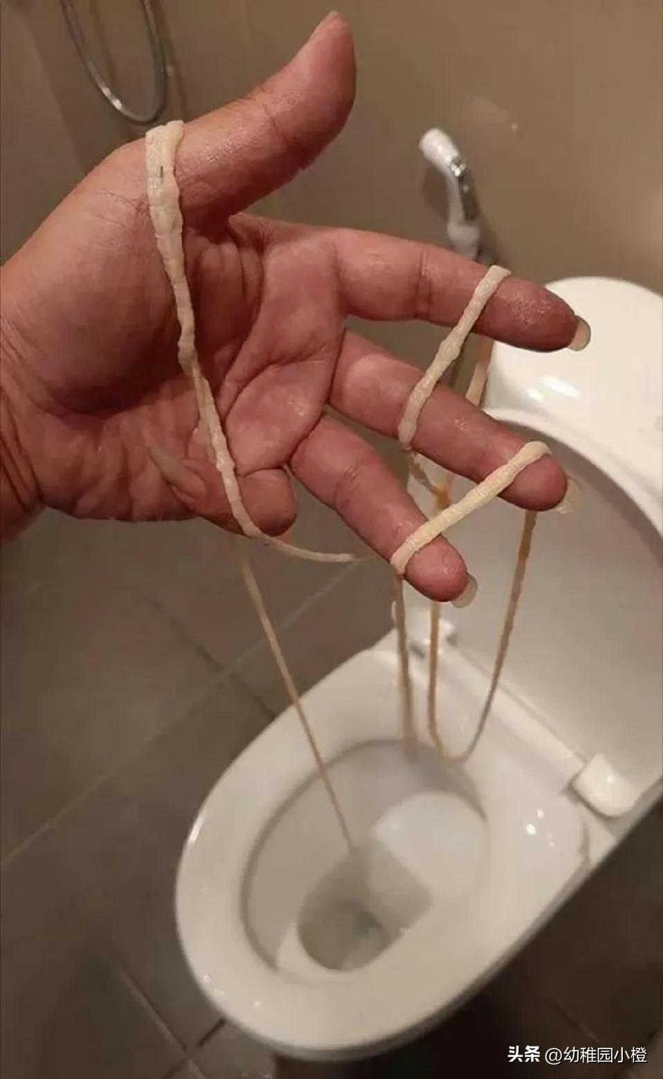 女子体内排出4米长绦虫是什么,宁德女子体内排出4米长绦虫