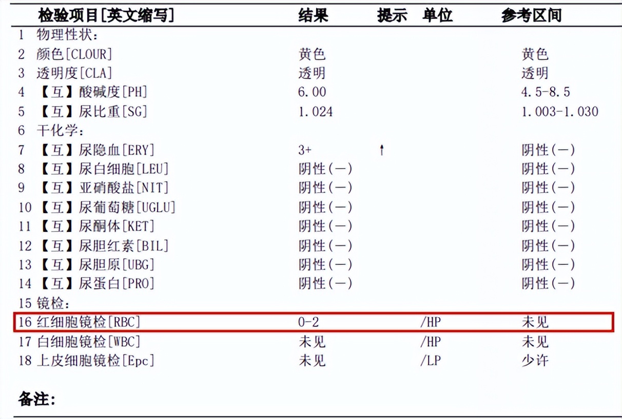 体检发现尿隐血阳性怎么办,体检发现了尿潜血该怎么办呢