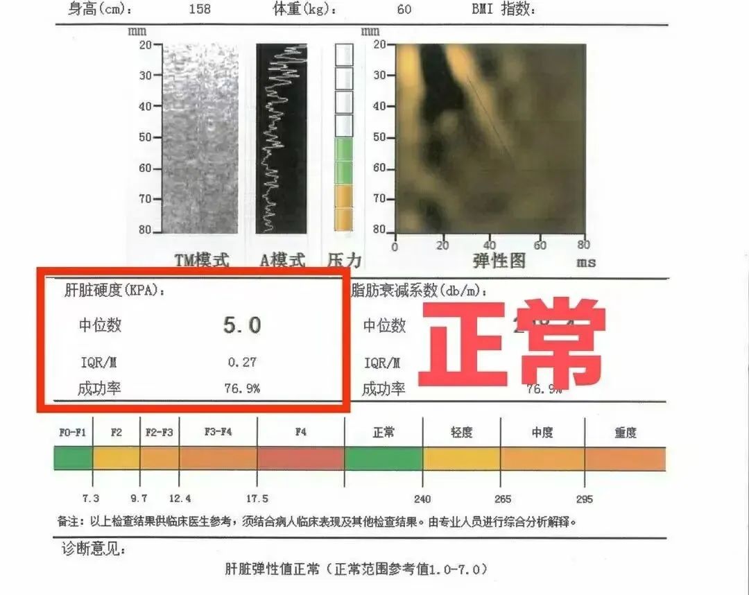 肝弹值高于多少就需要治疗?