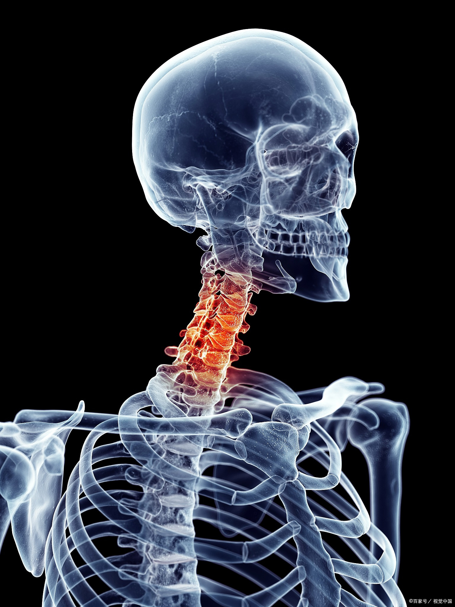 颈椎病手臂发凉酸痛发麻,神经根型颈椎病手臂发麻锻炼方法