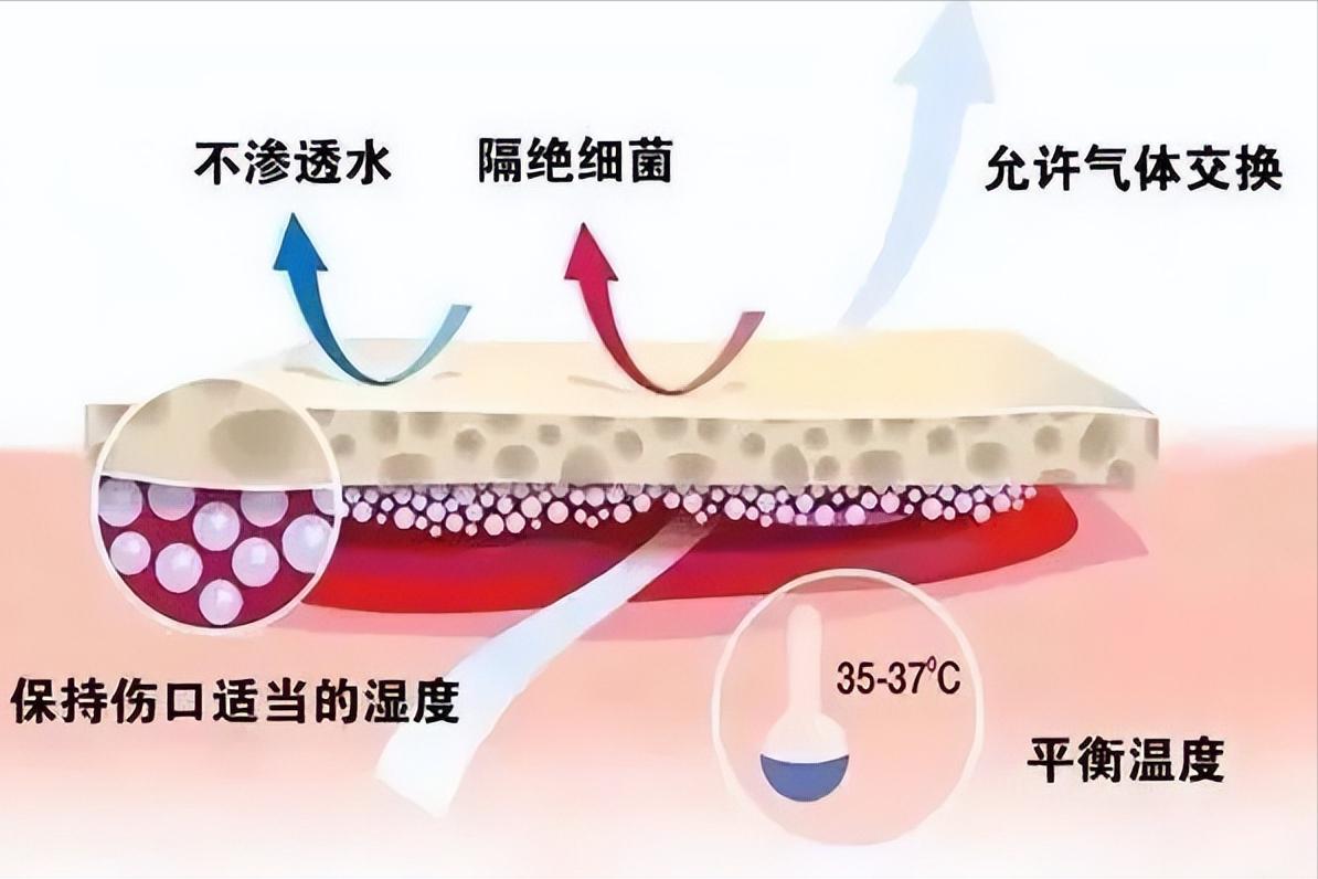 伤口湿性愈合和干性愈合的区别,干性愈合过程