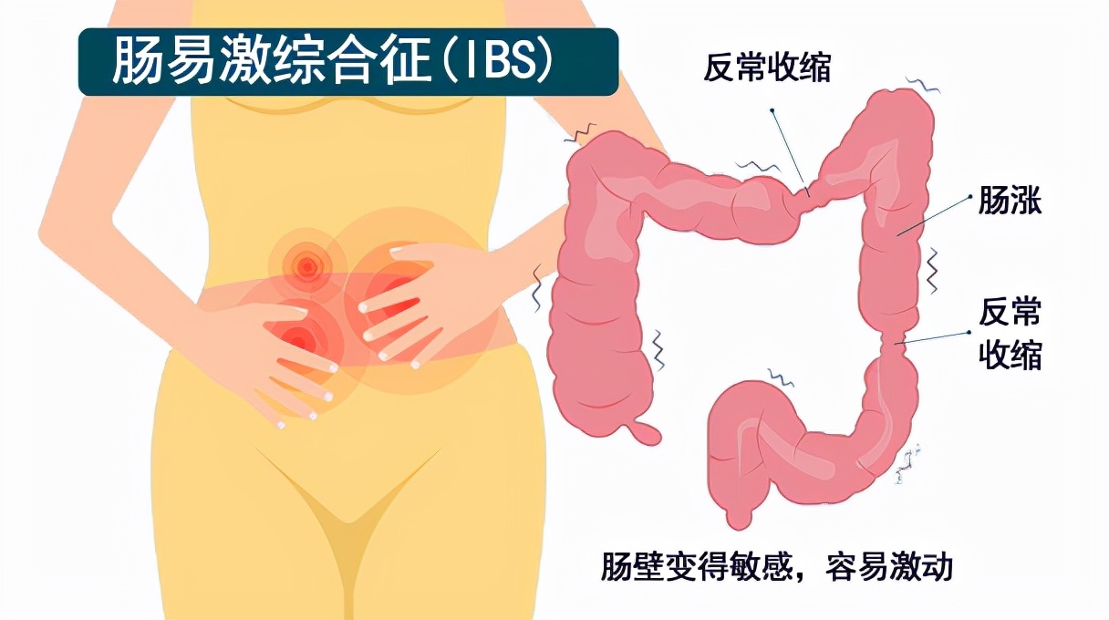 肠易激腹泻型会转变成便秘型吗,功能性便秘与肠易激综合征的区别