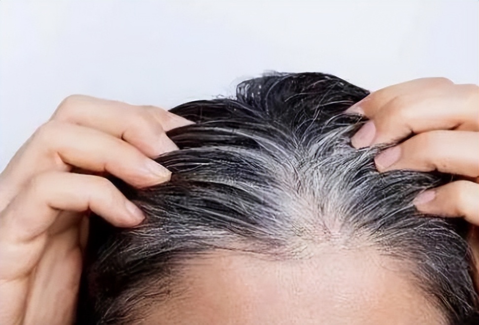 白头发什么原因产生的怎么治疗,白头发是从根部开始白是什么原因