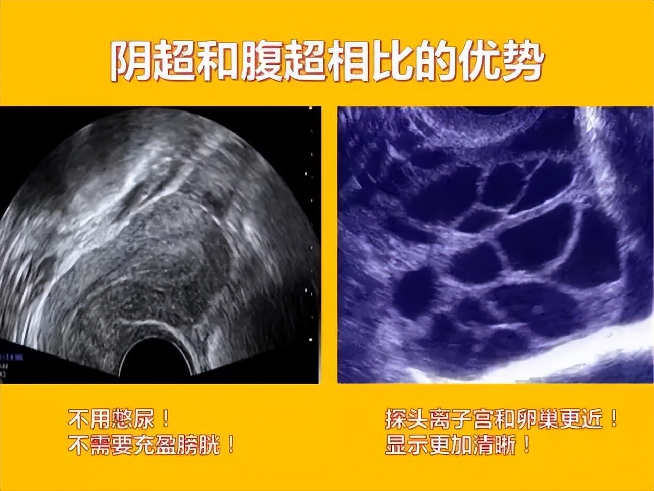 阴超可怕吗,阴超有多可怕啊