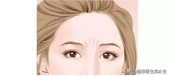 轻松去除面部皱纹的最有效方法,男士面部皱纹去除妙招