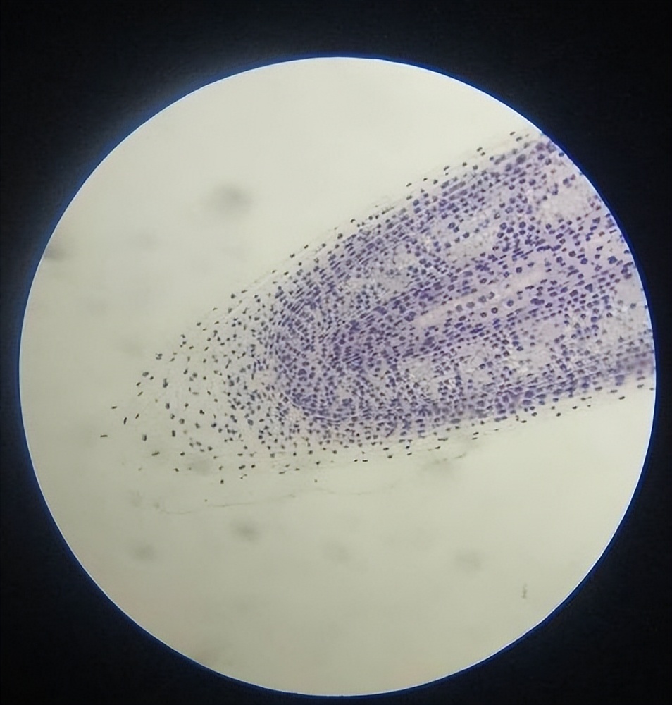氧化锌在饲料里的作用,氧化锌纳米材料的制备