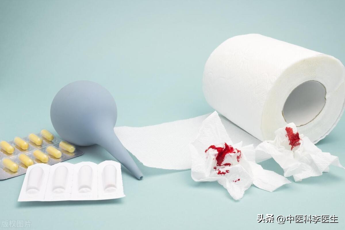 女性肛瘘手术恢复要几天,女子做肛瘘手术不尴尬吗