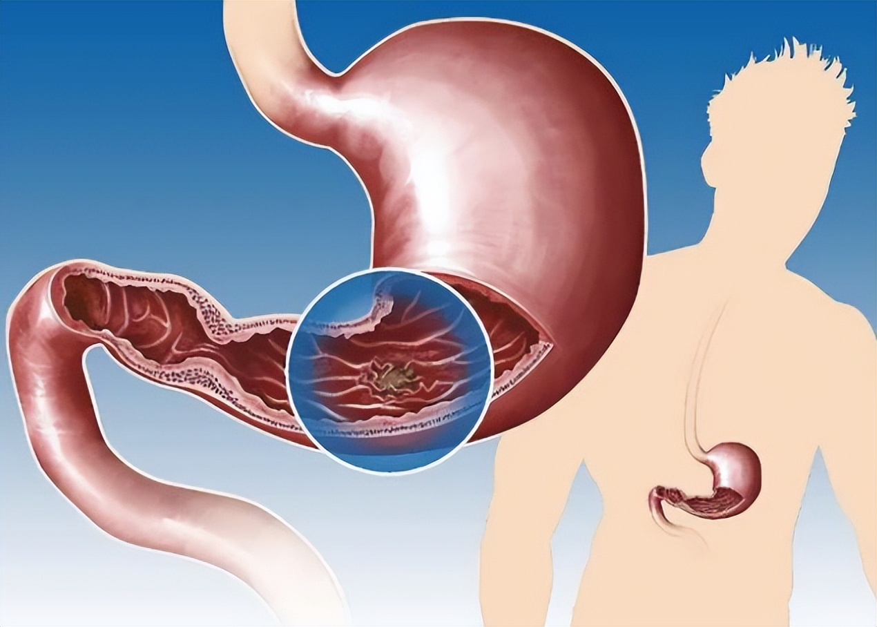 一般人日常有必要做胃镜检查吗,一般情况下有必要做胃镜检查吗