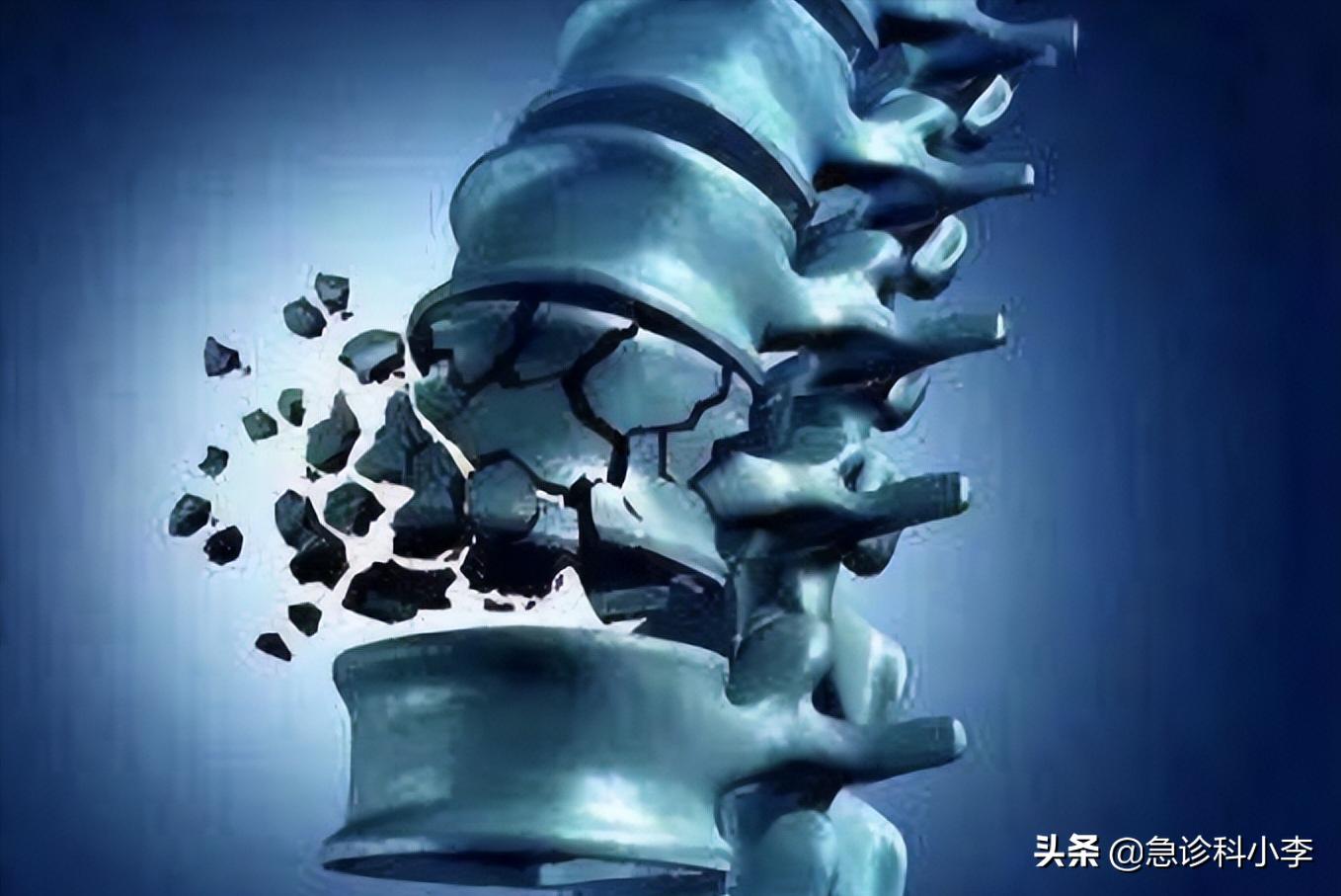 专治膝盖疼的针,膝盖打封闭针是什么样子的