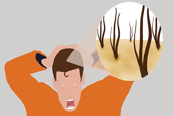 头皮痒一抓就起疙瘩怎么回事,头皮痒一抓就有血丝怎么回事