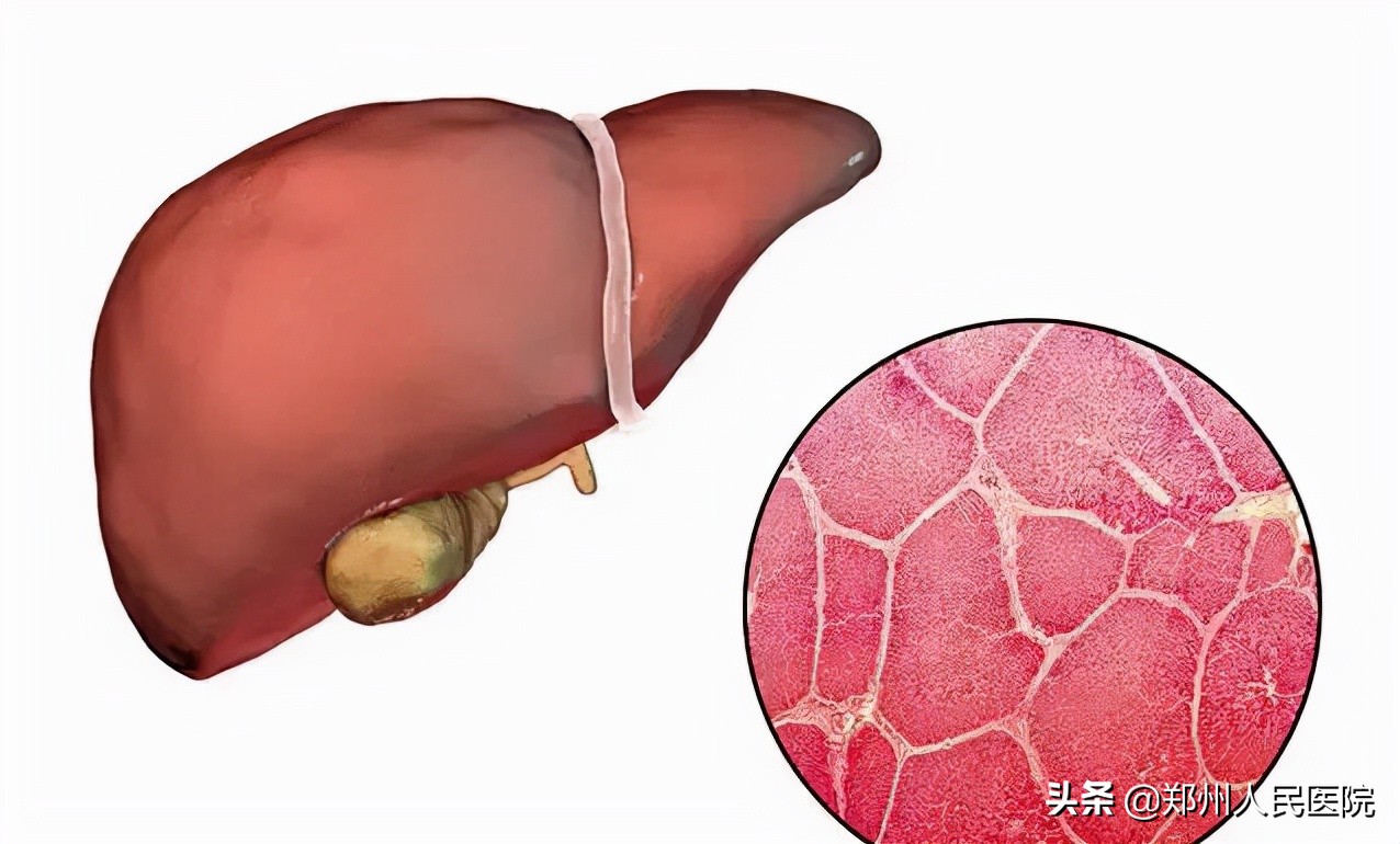 如何预防囊性肿瘤及囊肿,囊肿和肿瘤的判断方法