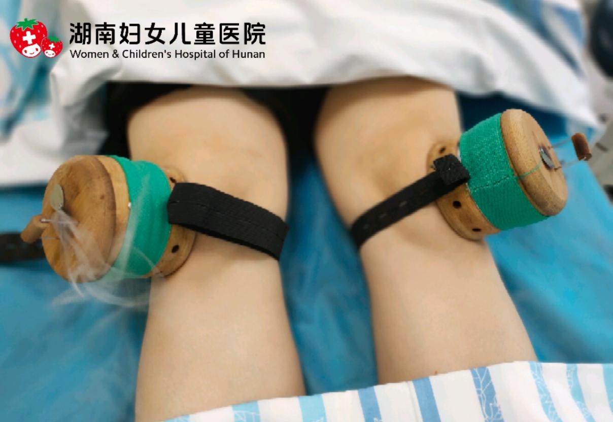 冬病夏治正当时三伏贴火热开贴,冬病夏治三伏贴全文