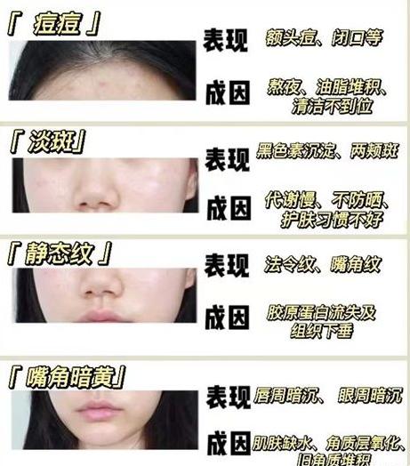 孕期用什么样的水乳比较好,孕期选水乳的注意事项