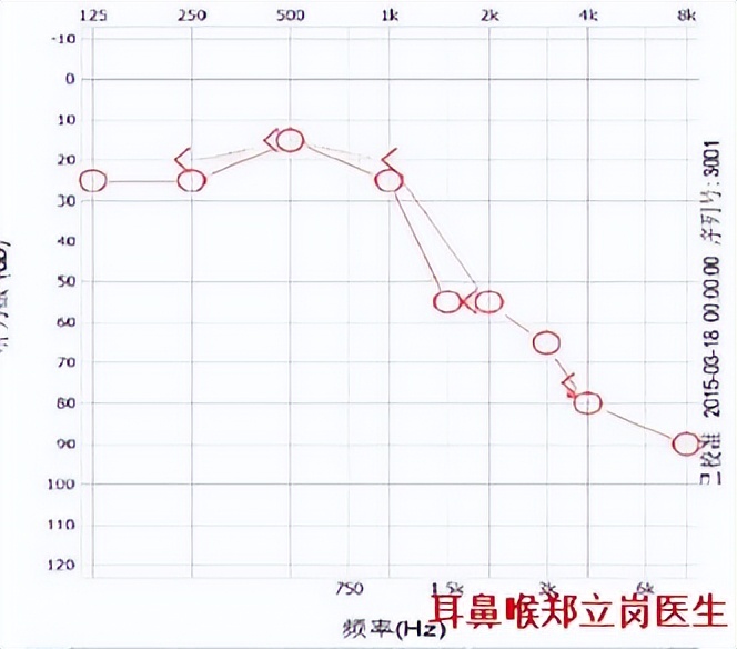 顽固眩晕，手术可治愈