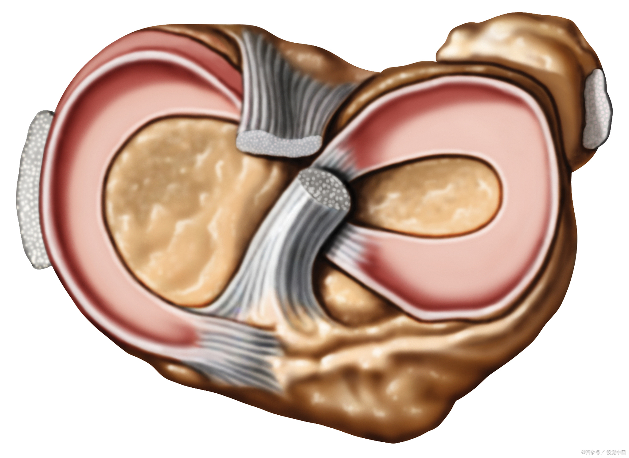 半月板损伤后喝中药要多长时间,半月板损伤中药调理方剂