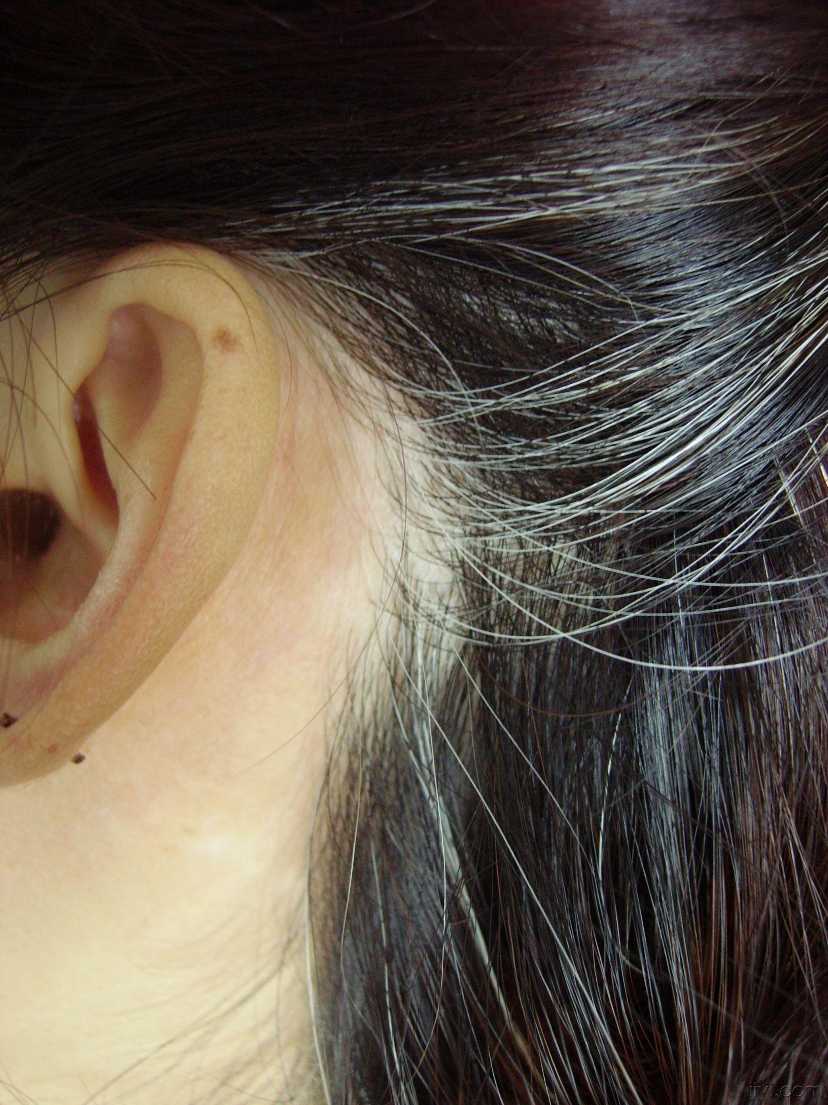 长白头发是缺少什么营养素,27岁女生长白头发吃什么营养素