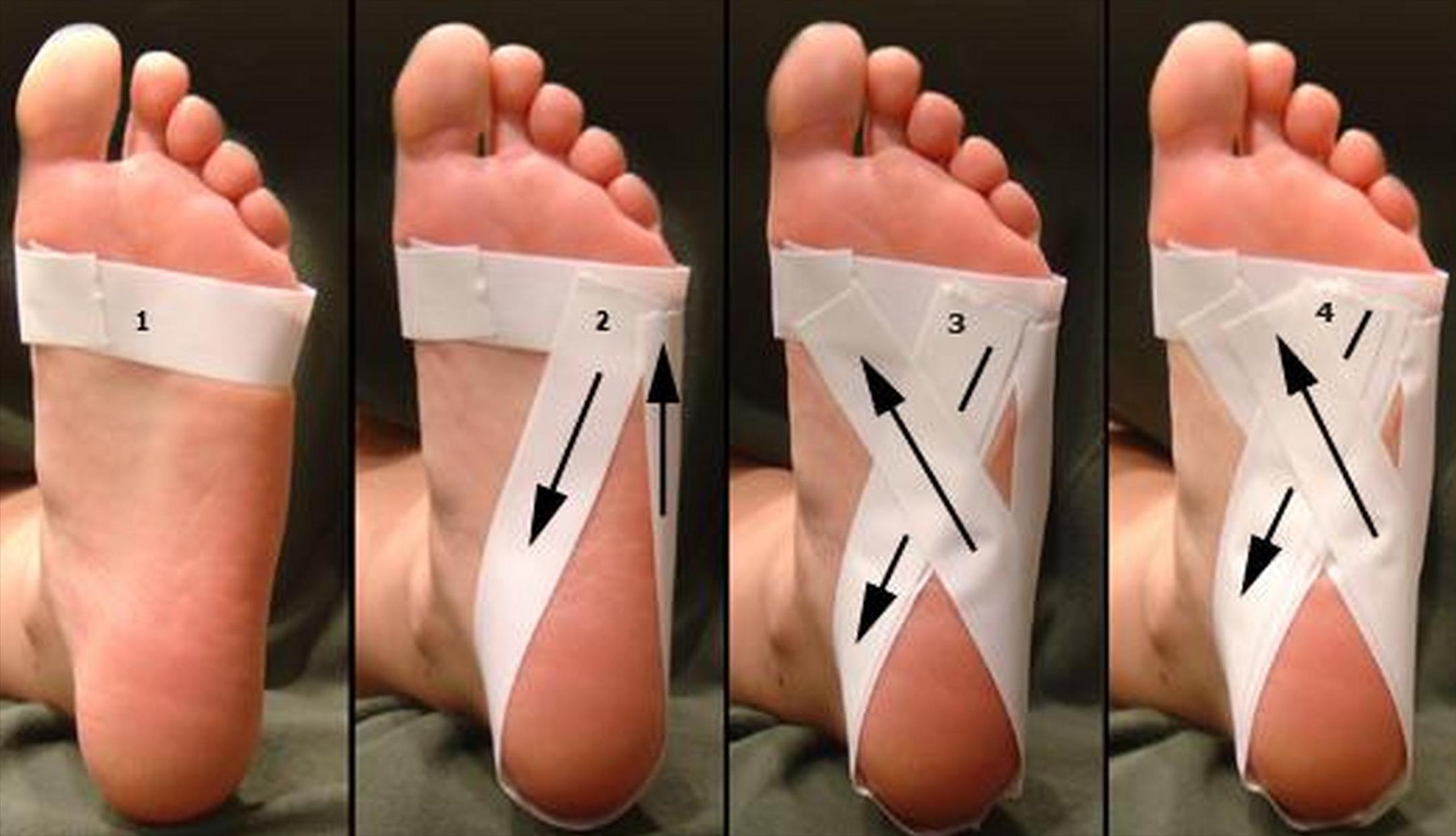 怎么缓解足底筋膜炎的疼痛,筋膜炎患者痛苦