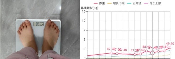 孕期预防妊娠纹小妙招,孕妇怎么防妊娠纹用什么