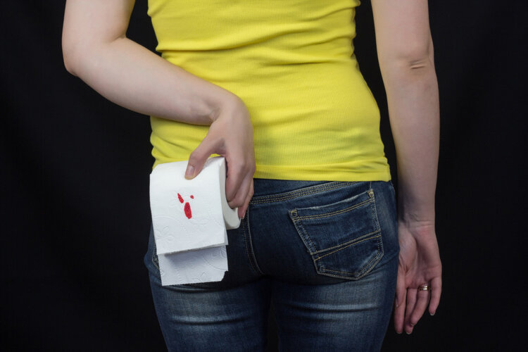 女孩子做痔疮手术的经历,23岁女孩分享痔疮手术的经历