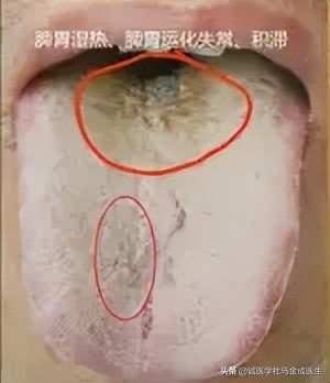 吃六味地黄丸上火？什么人不适合吃六味地黄丸？怎么吃不上火呢？