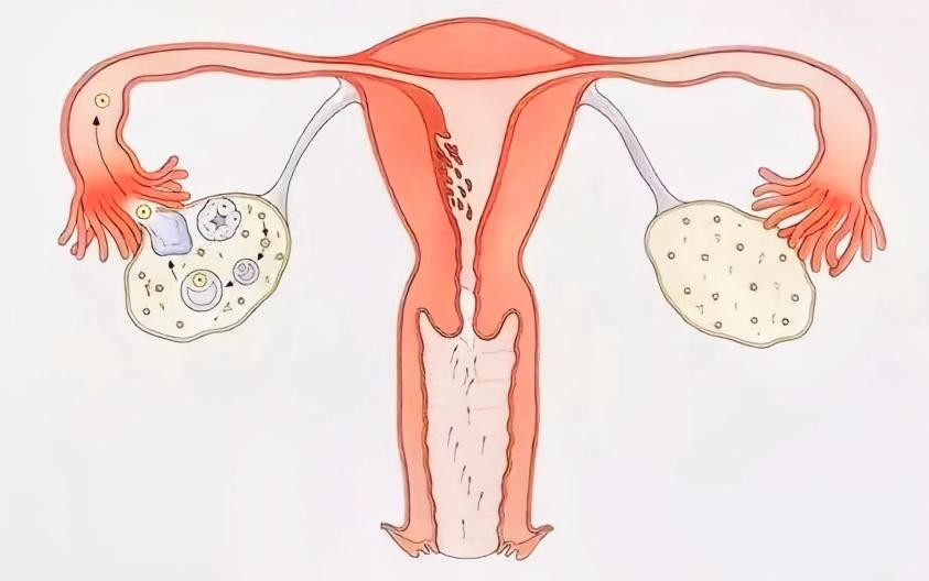 支原体转阴后仍有症状,支原体转阴后腺病毒阳了