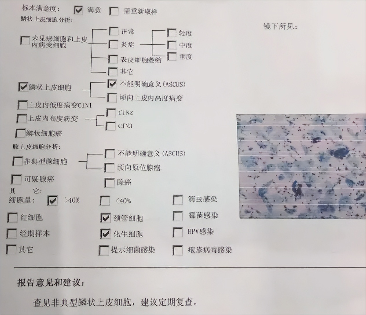 定期宫颈癌检查的目的是什么,宫颈癌定期复查的好处
