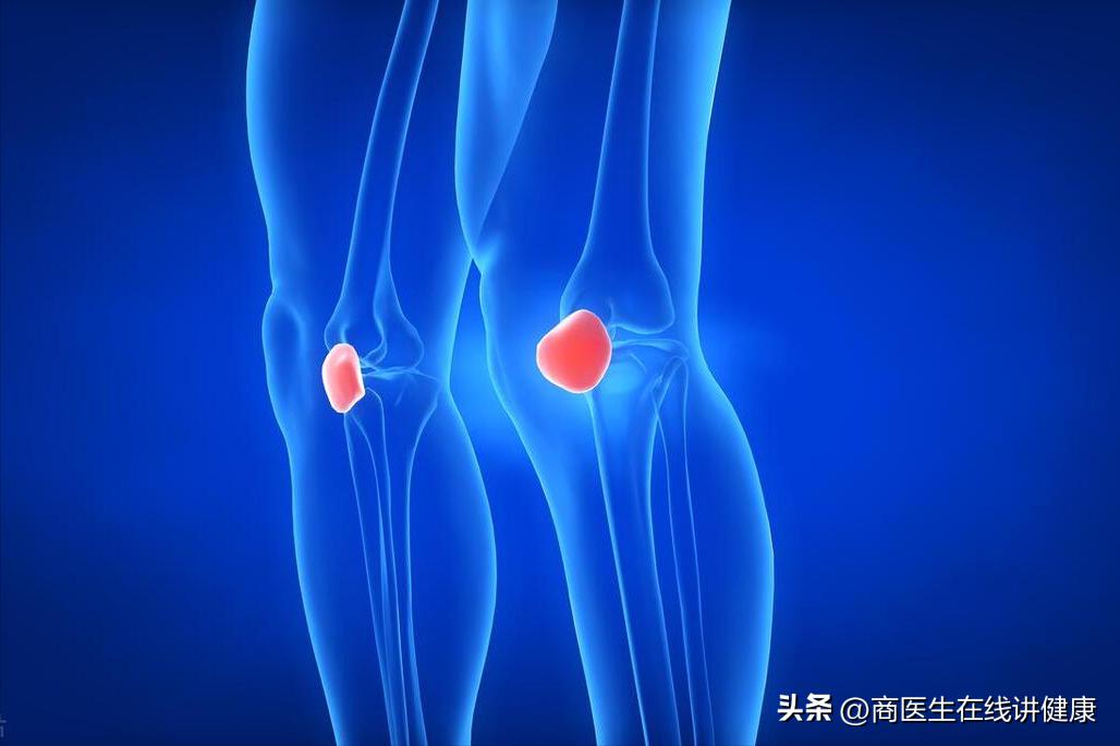 老年人如何缓解膝盖的疼痛,中老年人突然膝盖痛是什么原因