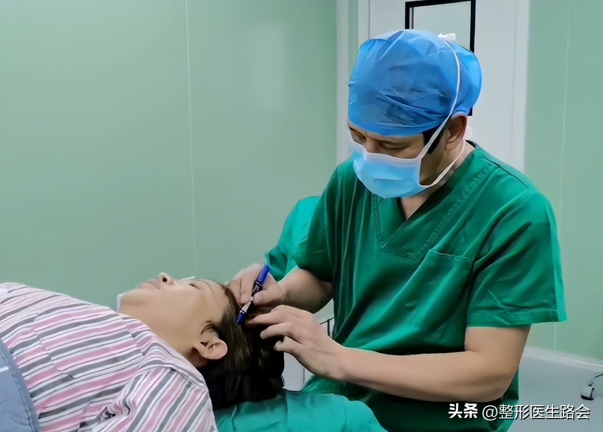 上海九院膨体填充太阳穴费用多少,膨体丰太阳穴视频全过程