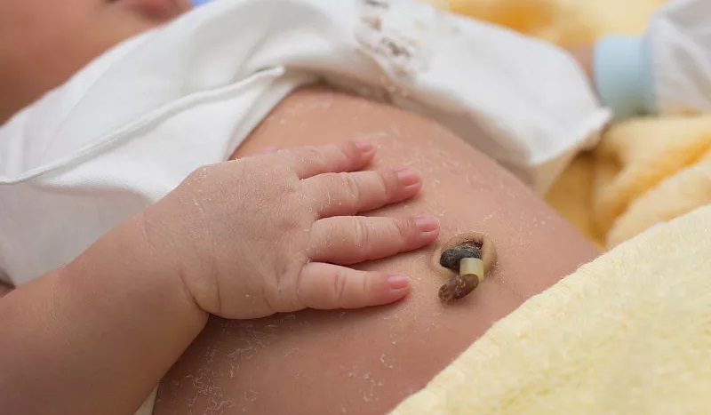 照顾新生儿的最佳方法,如何照顾新生儿三多三勤4不要