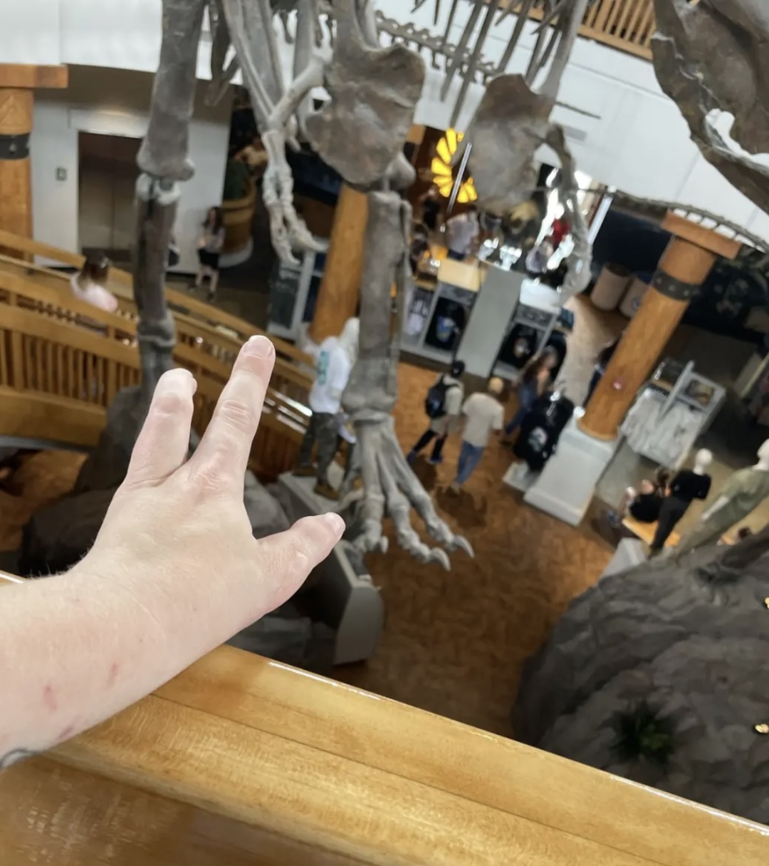 妹子天生只有3根手指，别人说她“霸王龙”，她用乐观狠狠反击！