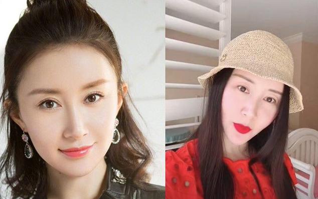 整容毁掉的四位女星,盘点整容失败惨不忍睹的十大女星