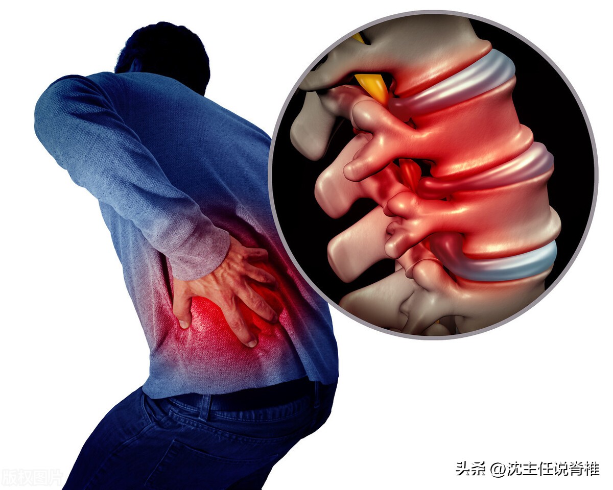 腰椎间盘突出臀部肌肉减少怎么办,腰椎间盘突出引起臀部痛如何治疗