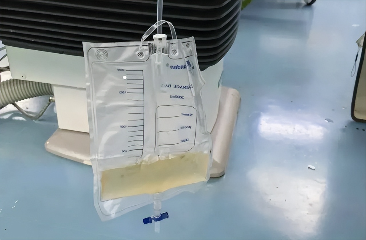 让人尴尬的医院检查项目,医院最尴尬的几个检查