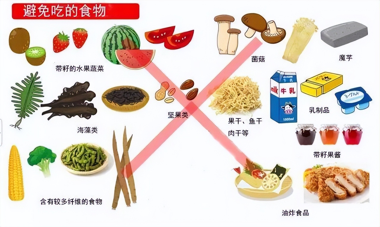 肠镜报告说肠道清洁较差,结肠镜检查前肠道清洁准备