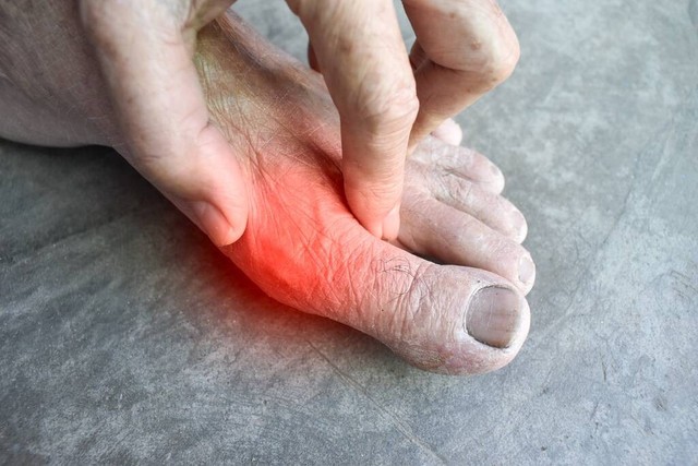 华佗留下的治痛风名方，如今我分享出来造福世间