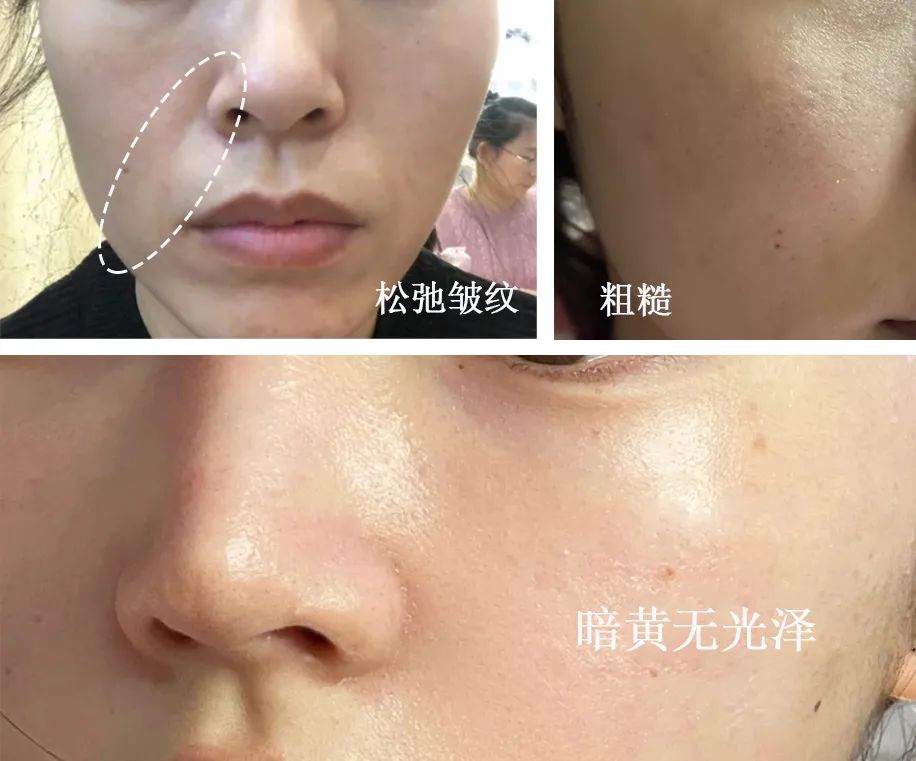 兰蔻菁纯眼精华秒杀,兰蔻菁纯臻颜玫瑰精萃水150ml价格