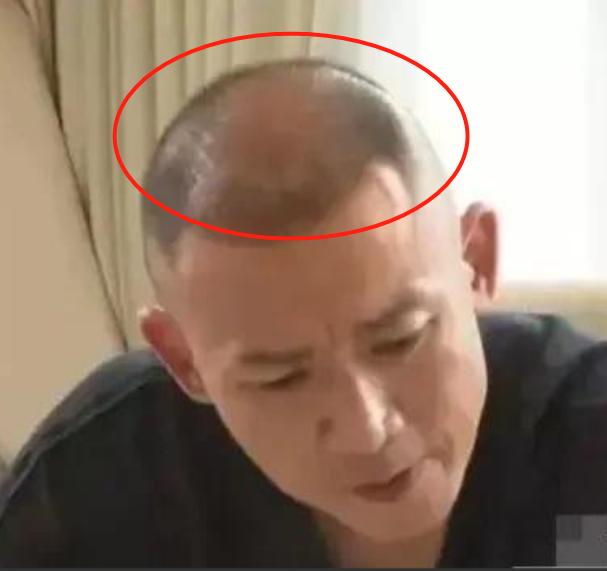 发际线秃的男星,盘点十大秃头男星佩戴假发